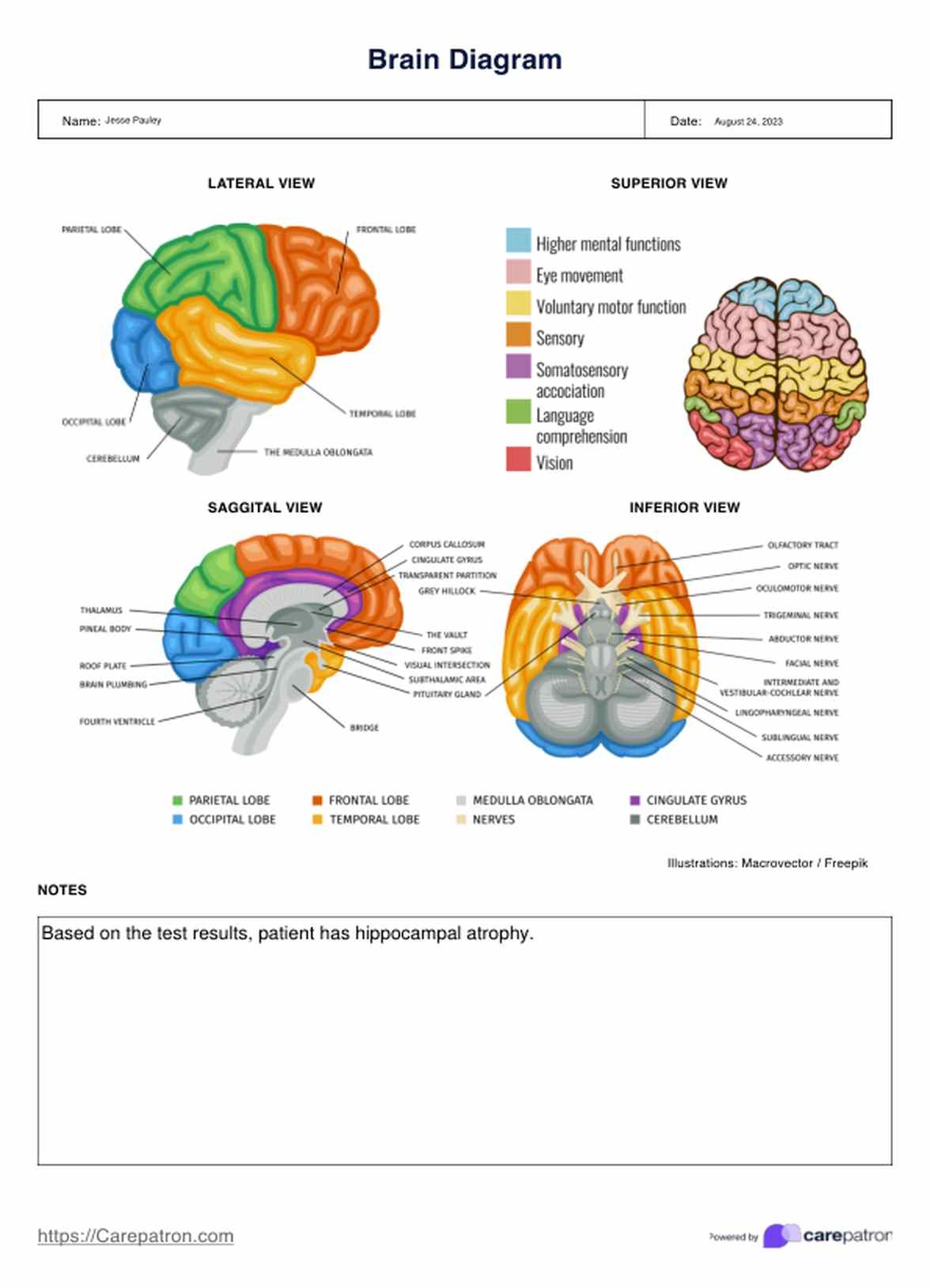 Brain Diagram Example Free PDF Download